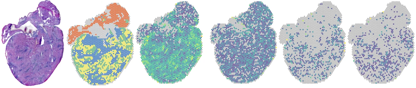 Gene-expression maps of heart sections from mice infected with reovirus
