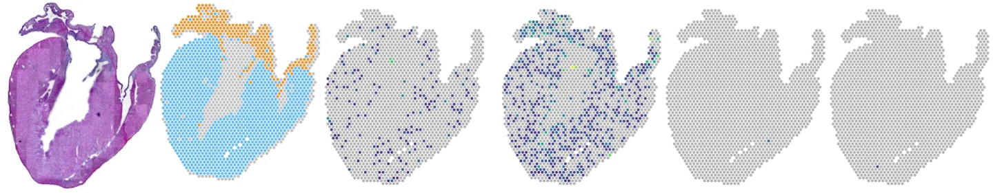 Gene-expression maps of uninfected mouse heart longitudinal sections